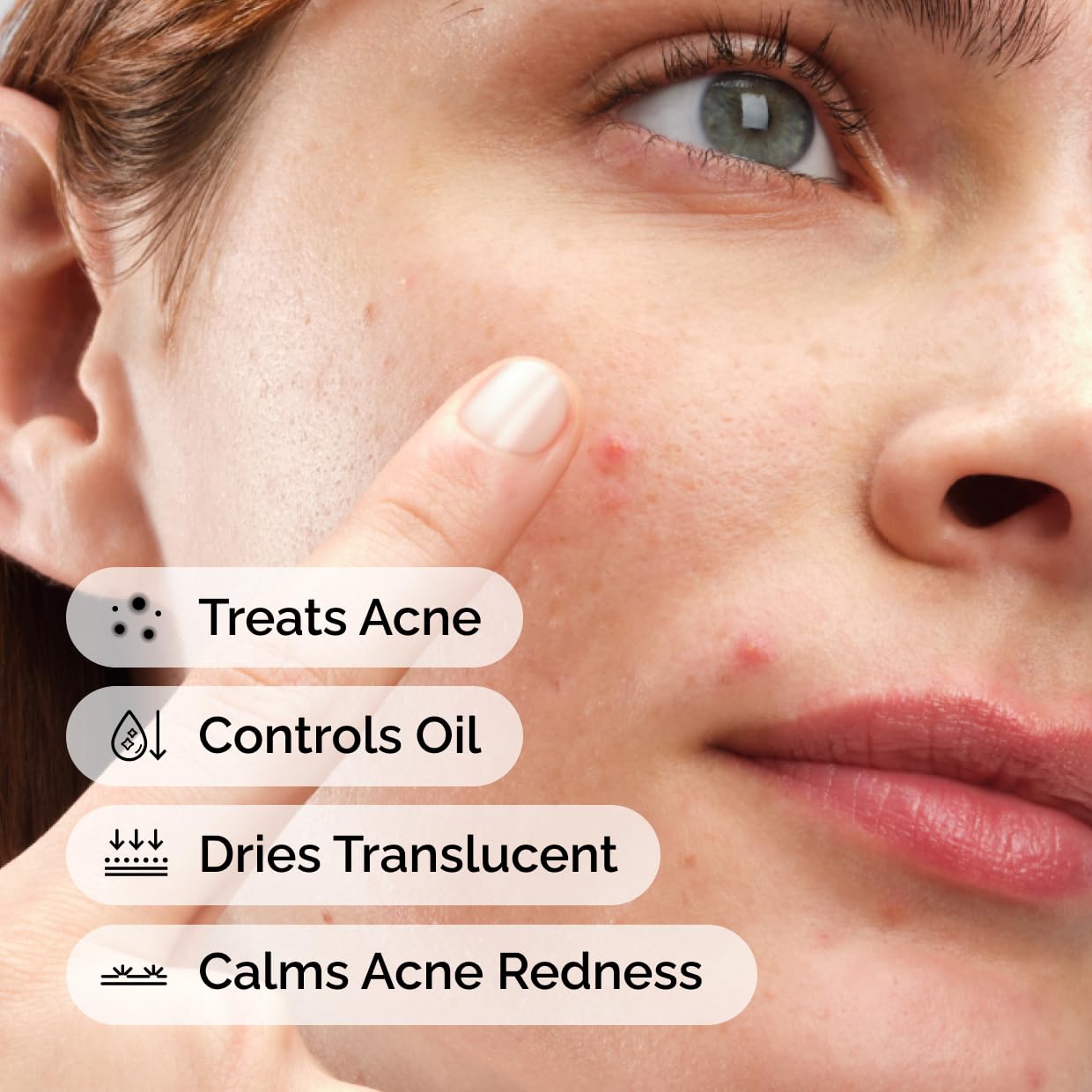 The Ordinary Sulfur 10% Powder-to-Cream Acne Spot Treatment Concentrate, Reduces Pimple Size and Zit Redness, 0.18 Oz The Ordinary