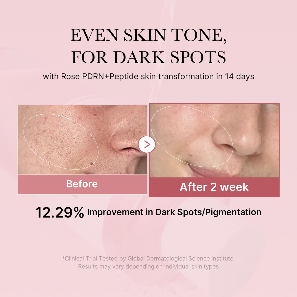 medicube PDRN Toner Rose PDRN Peptide Toner | Lightweight & Watery Type for Skin Boosting, Soothing and Calming, Uneven Skin Tone | with Rose, Peptide, Niacinamide | Korean Skincare, 8.45 fl.oz medicube