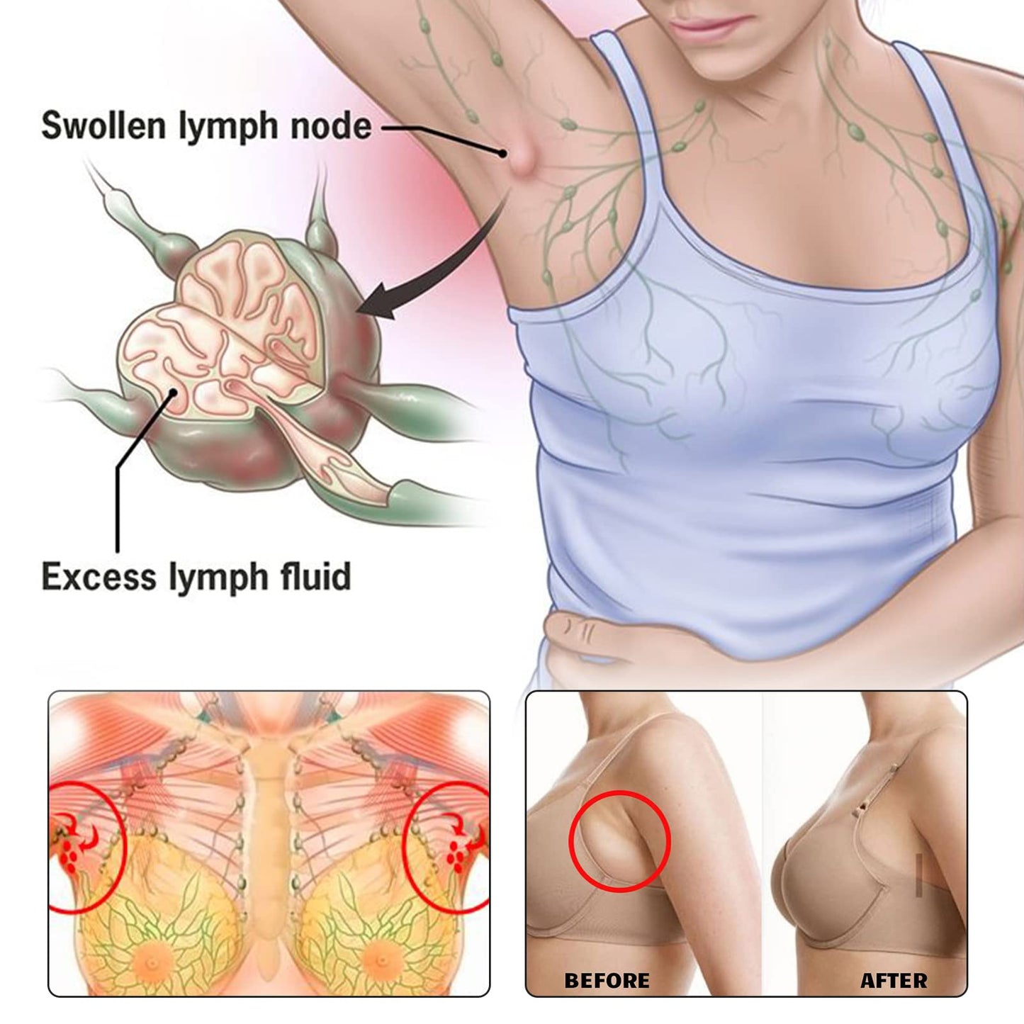 BXQJRJ 24Pcs/Box Herbal Lymph Nodes Patch,Lymphatic Drainage Patch/Patches,Herbal Lymphatic Drainage Care Patch,Neck Lymph Nodes Patch, Lymphatic Massage for Men and Women BXQJRJ