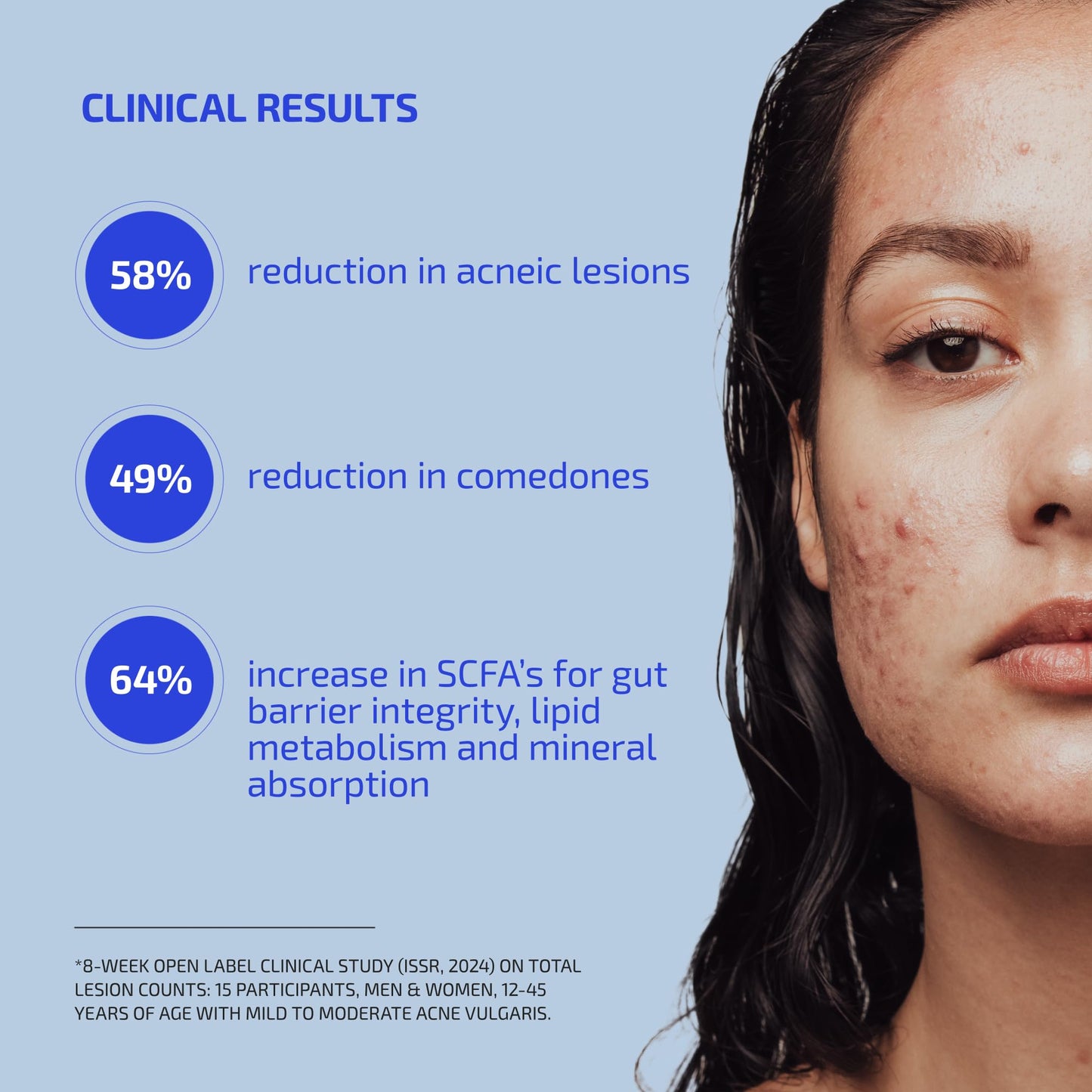 Codex Labs Shaant Clear Skin Supplement – 60 Vegan Capsules | Acne Probiotics with 9-Strain Blend, Green Tea EGCG & Guggul – Daily Support for Acne-Prone Skin & Clear Complexion Codex Labs