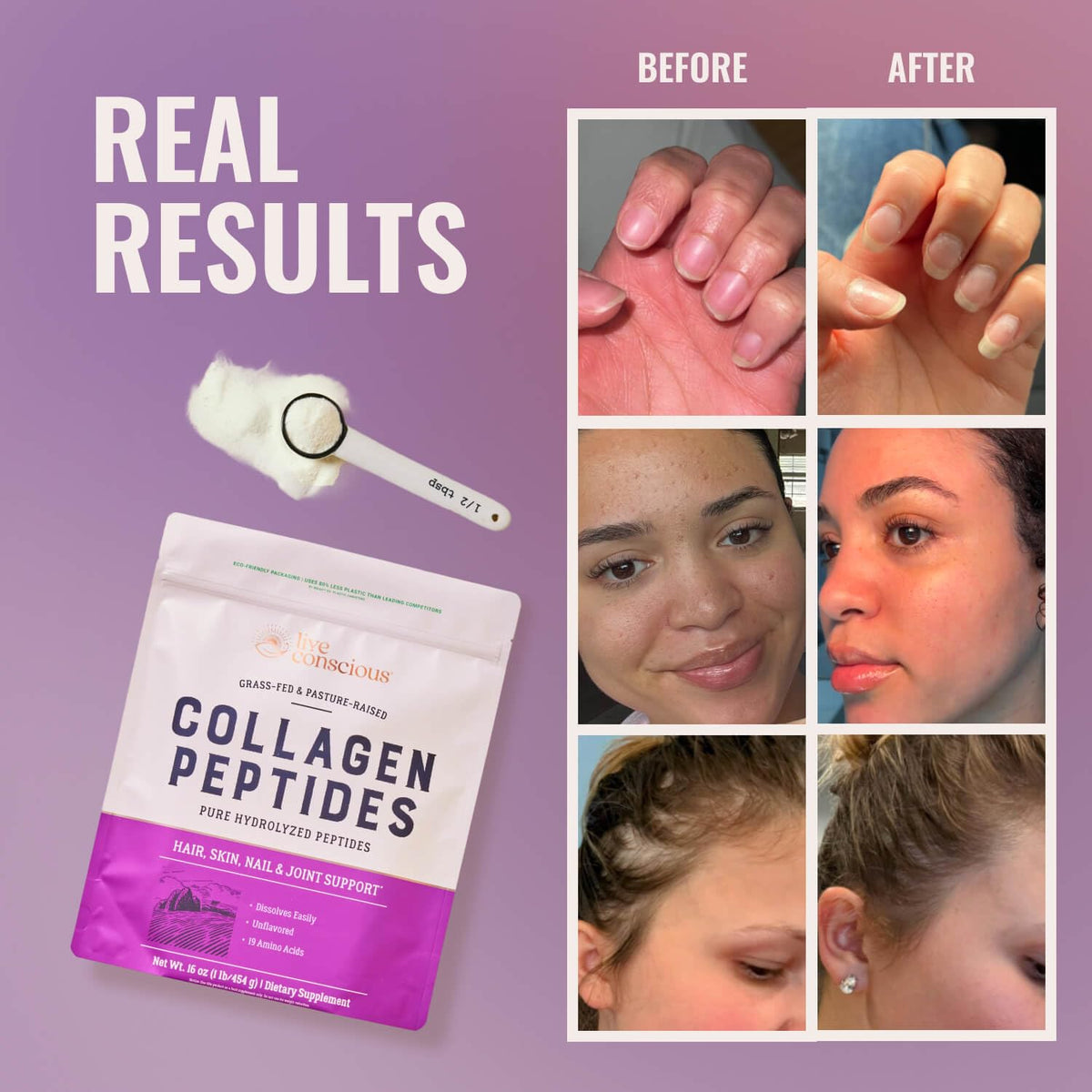 Live Conscious Collagen Peptides Powder - Naturally-Sourced Hydrolyzed Collagen Powder - Hair, Skin, Nail, and Joint Support - Type I & III Grass-Fed Collagen Live Conscious