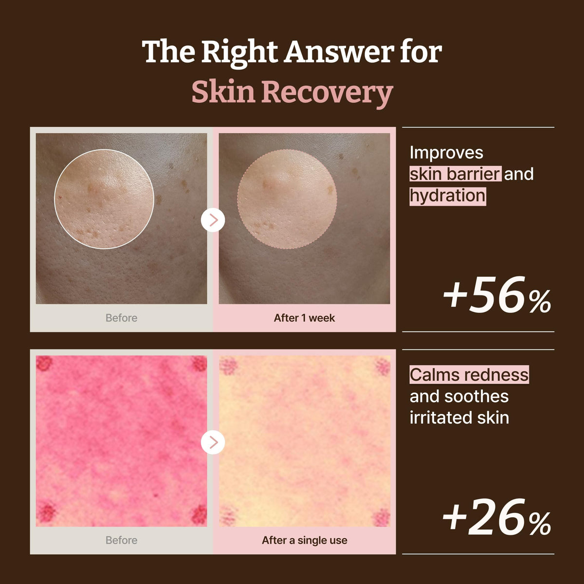 Dr.Reju-All PDRN All-Day Glow Duo: Advanced PDRN Rejuvenating Cream + Advanced PDRN Rejuvenating Mask - Face Moisturizer & Facial Mask for Hydration & Plumping - Korean Skin Care Daily Routine Dr.Reju-All