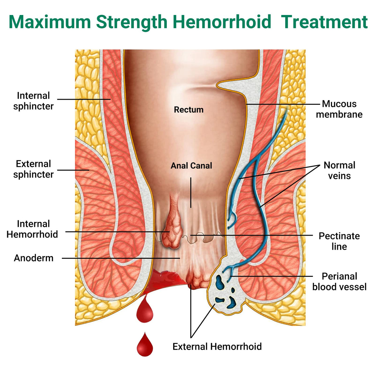 Hemorrhoid Treatment Ointment, Maximum Strength Treatment & Fast Relief for Pain, Itching, Burning, Swelling, Fissure, Bleeding, Discomfort, Long-Lasting Internal & External Hemorrhoid Cream, (2-Pack) LMNOOP