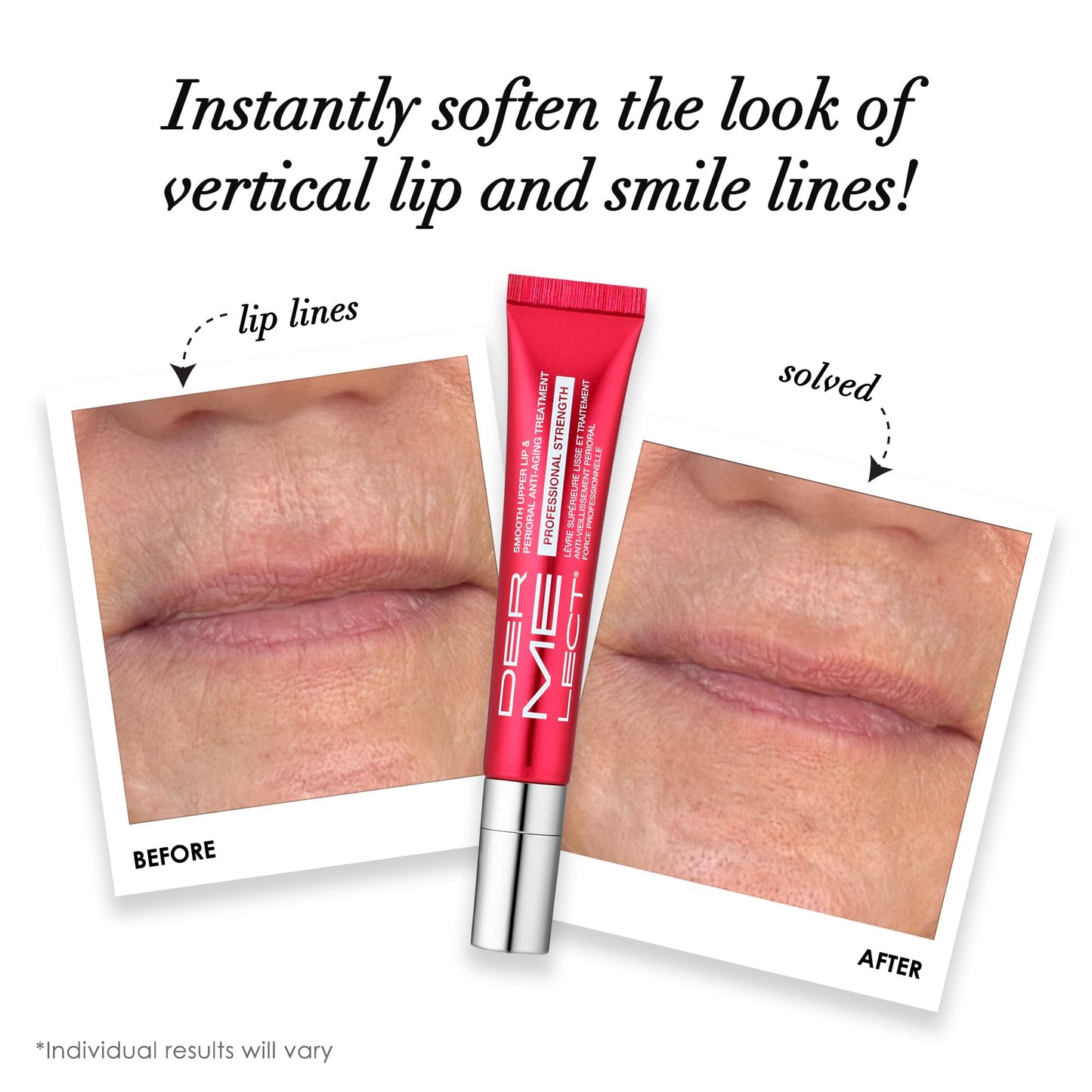 Dermelect Smooth Upper Lip & Perioral Anti-Aging Treatment - Professional Strength 15ml Dermelect