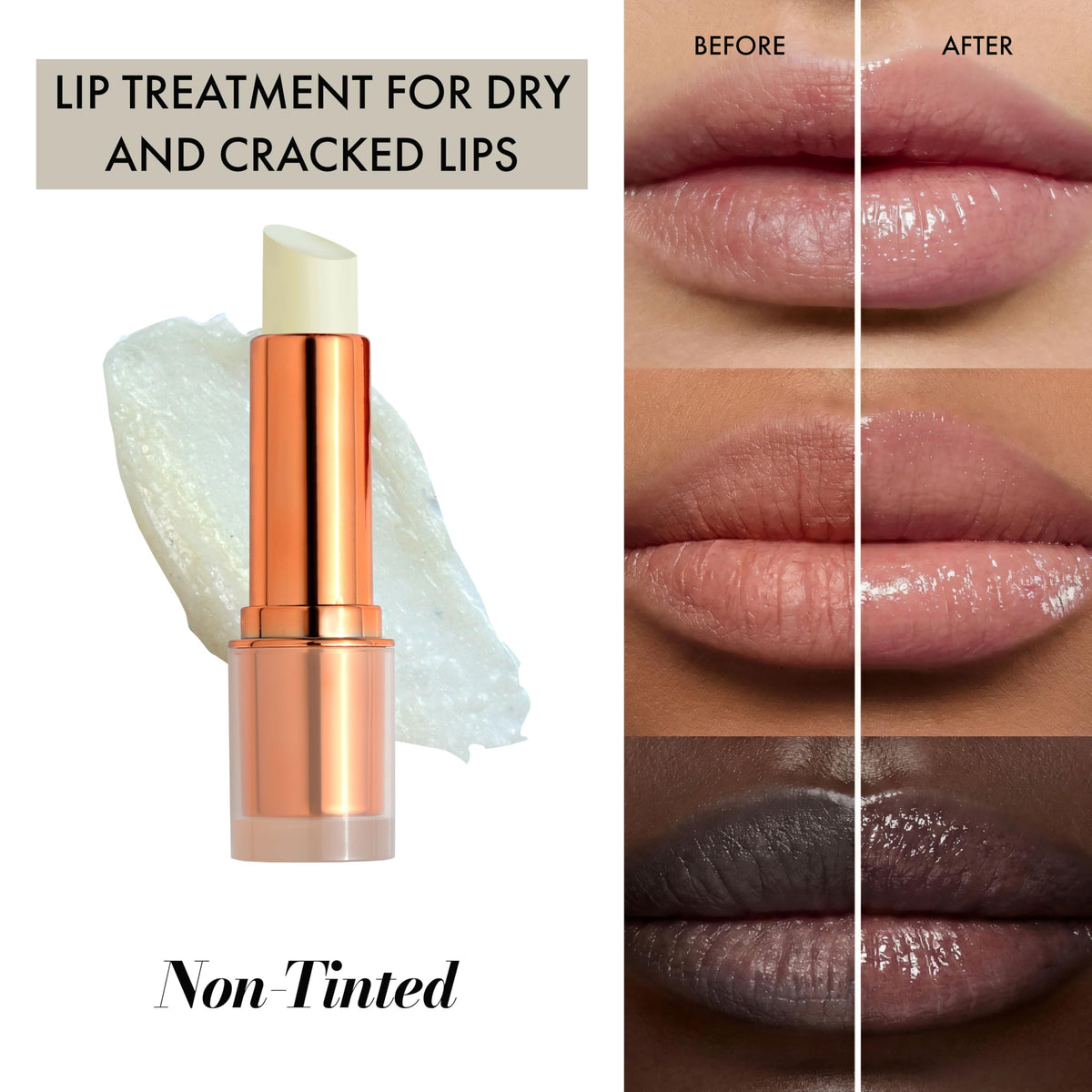 Clinexil Lip Balm – Hydrating Lip Repair with Cold-Pressed Oils, 10% Squalane, Vitamin E & Ceramides Clinexil