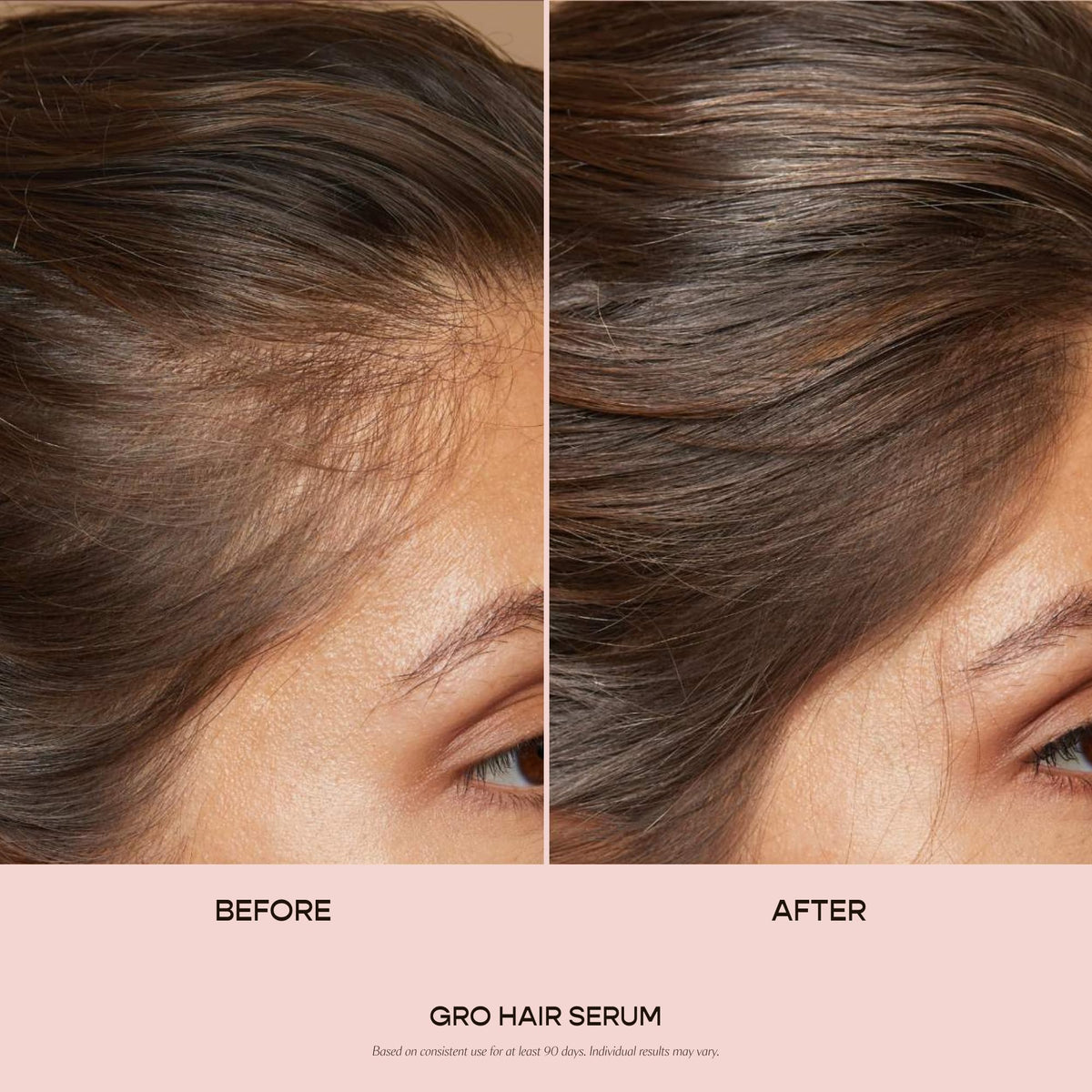 VEGAMOUR GRO Hair Serum for Hair Thinning, Thicker Fuller Looking Hair, Non Oily Tonic, 3 pack, 90 day supply VEGAMOUR