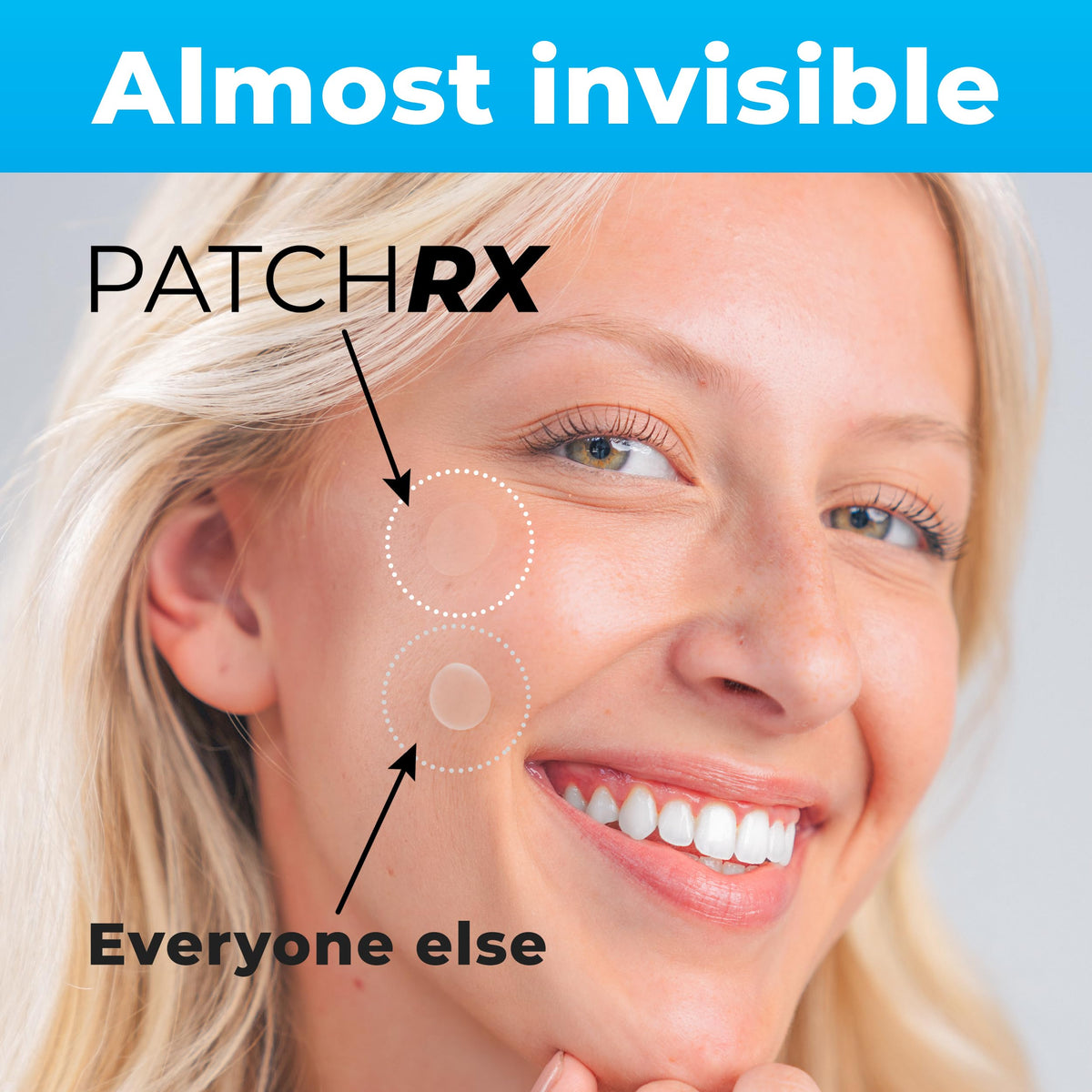 PatchRx Pimple Patches for Face (120 Patches), Hydrocolloid Acne Patches with Tea Tree Oil PatchRx