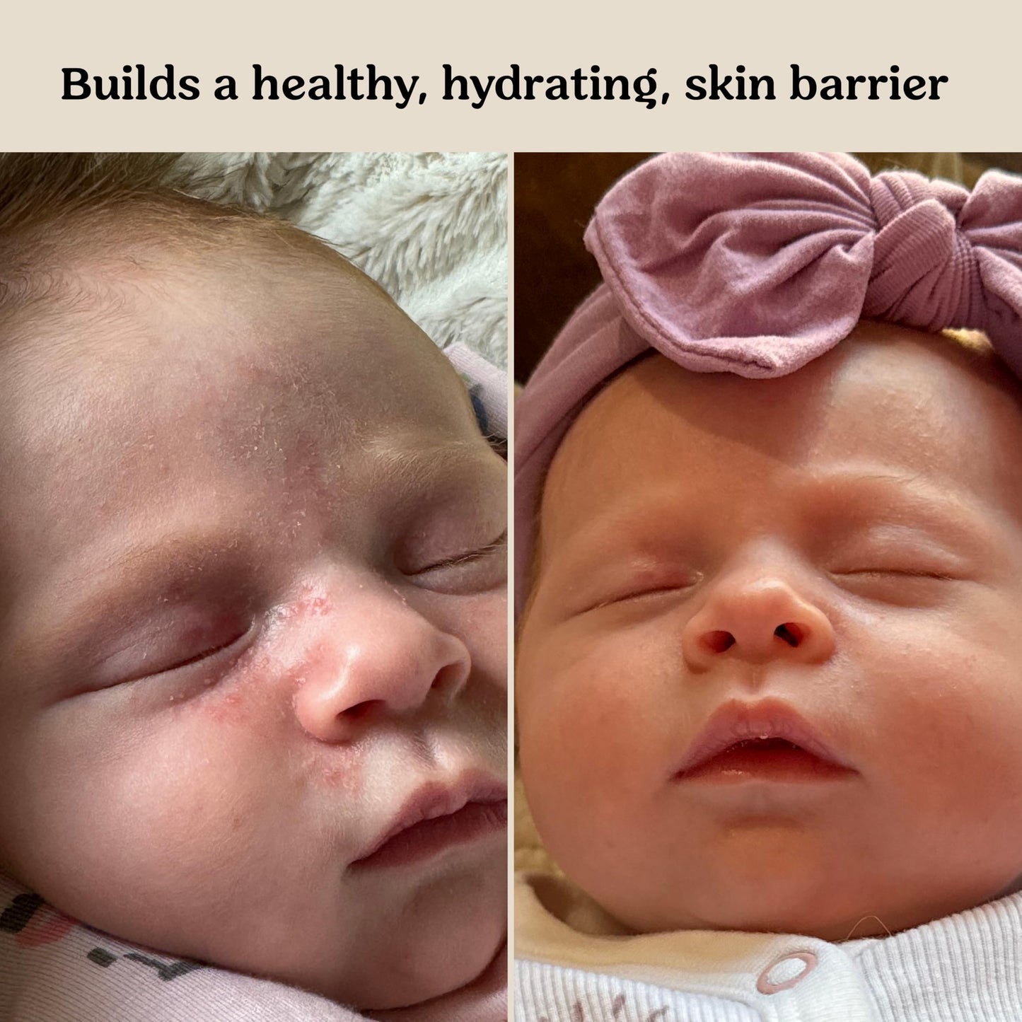 Roe Wellness- Baby Cream Lotion Ointment EWG Verified Non-Toxic Ingredients | Full Body Biome Barrier | Dry Skin, Itch Relief, Moisturizing, All Over Ointment | Toddlers & Kids Gsupps Australia