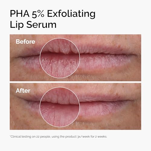 The Ordinary PHA 5% Exfoliating Lip Serum, Hydrating Overnight Lip Exfoliator Treatment, 0.5 Fl Oz The Ordinary