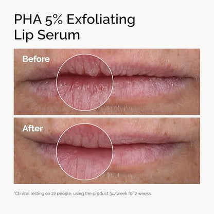 The Ordinary PHA 5% Exfoliating Lip Serum, Hydrating Overnight Lip Exfoliator Treatment, 0.5 Fl Oz The Ordinary