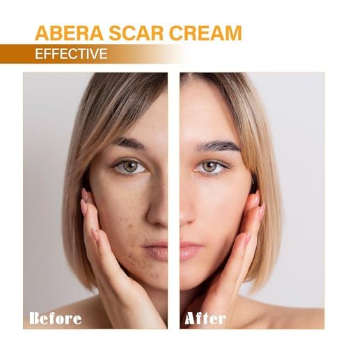 ABERA Scar Removal Cream for Women and Men - Rapid Repair of New Old Scars, Spots, Burns All Natural Treatment with Vitamin E, Alanine, Collagen (1 Box + 3 Eye Patch) ABERA buy australia supplements