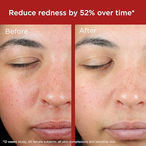 EltaMD UV Skin Recovery Green Tint 100% Mineral Sunscreen, SPF 50, Redness Correcting EltaMD