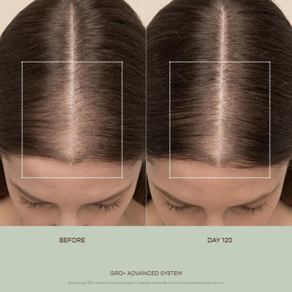 VEGAMOUR GRO+ Advanced Balancing Shampoo and Conditioner Kit | Removes Buildup, Hydrates the Scalp and Softens Strands | For Severe Signs of Thinning | Color Safe, Vegan, Cruelty-Free (8 Fl Oz each) VEGAMOURBuy Supplements Australia