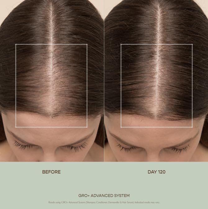 VEGAMOUR GRO+ Advanced Essentials Kit | Removes Buildup, Improves Hair Density, Reduces Shedding, Hydrates and Exfoliates the Scalp | For Severe Signs of Thinning | Color Safe, Vegan, Cruelty-Free VEGAMOURBuy Supplements Australia
