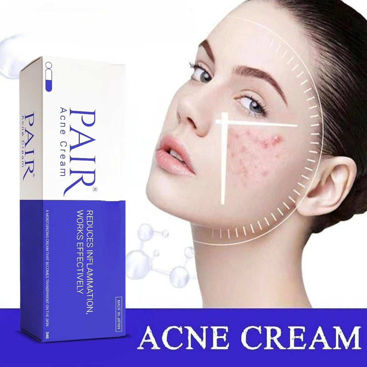 Pair Acne Cream for Face, 14g (0.5 fl oz) Small Pack – Made in Japan SKINSINS