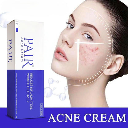 Pair Acne Cream for Face, 14g (0.5 fl oz) Small Pack – Made in Japan SKINSINS
