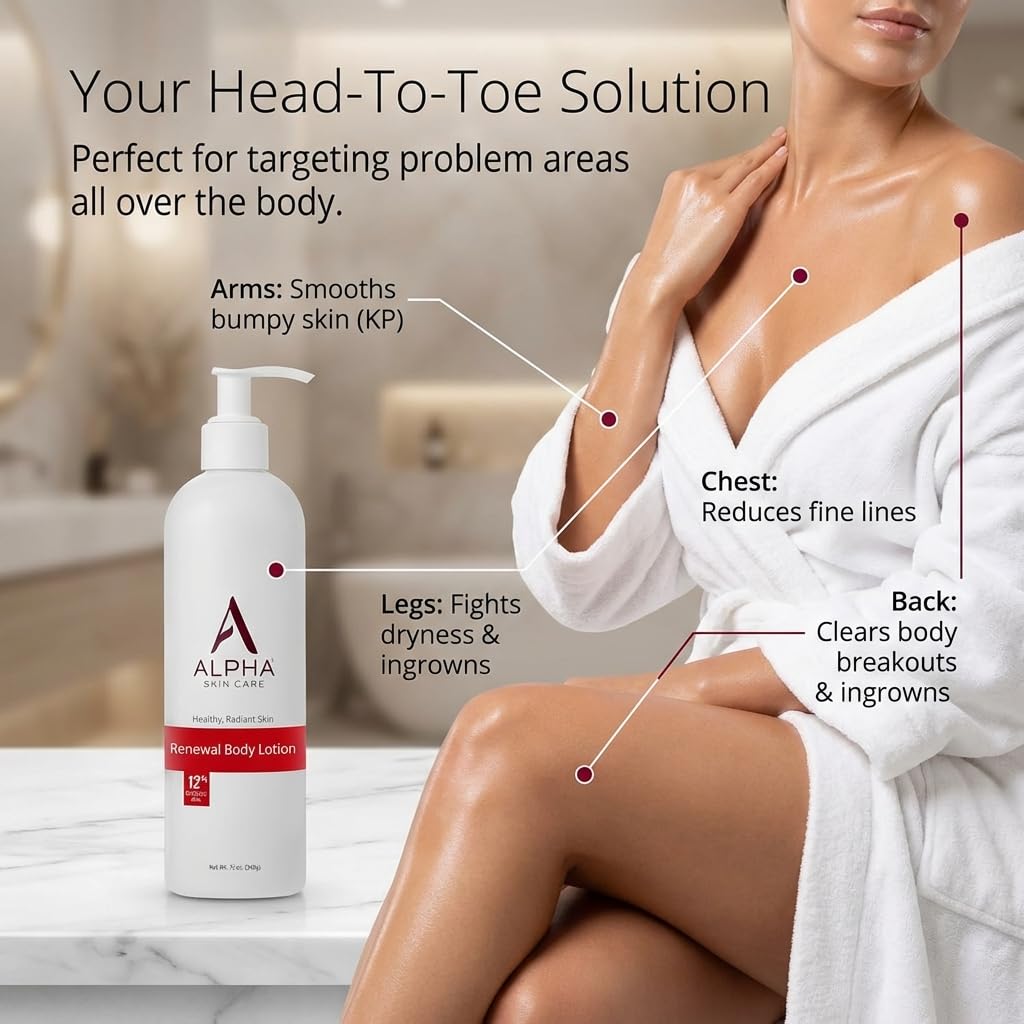 Alpha Skin Care Revitalizing Body Lotion, 12% Glycolic AHA, 12 Oz Alpha
