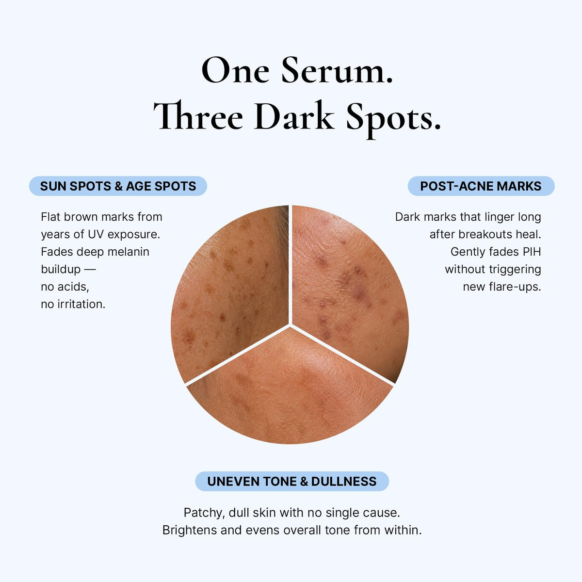 EnaSkin Dark Spot Corrector & Remover Serum for Face & Body, Niacinamide EnaSkin
