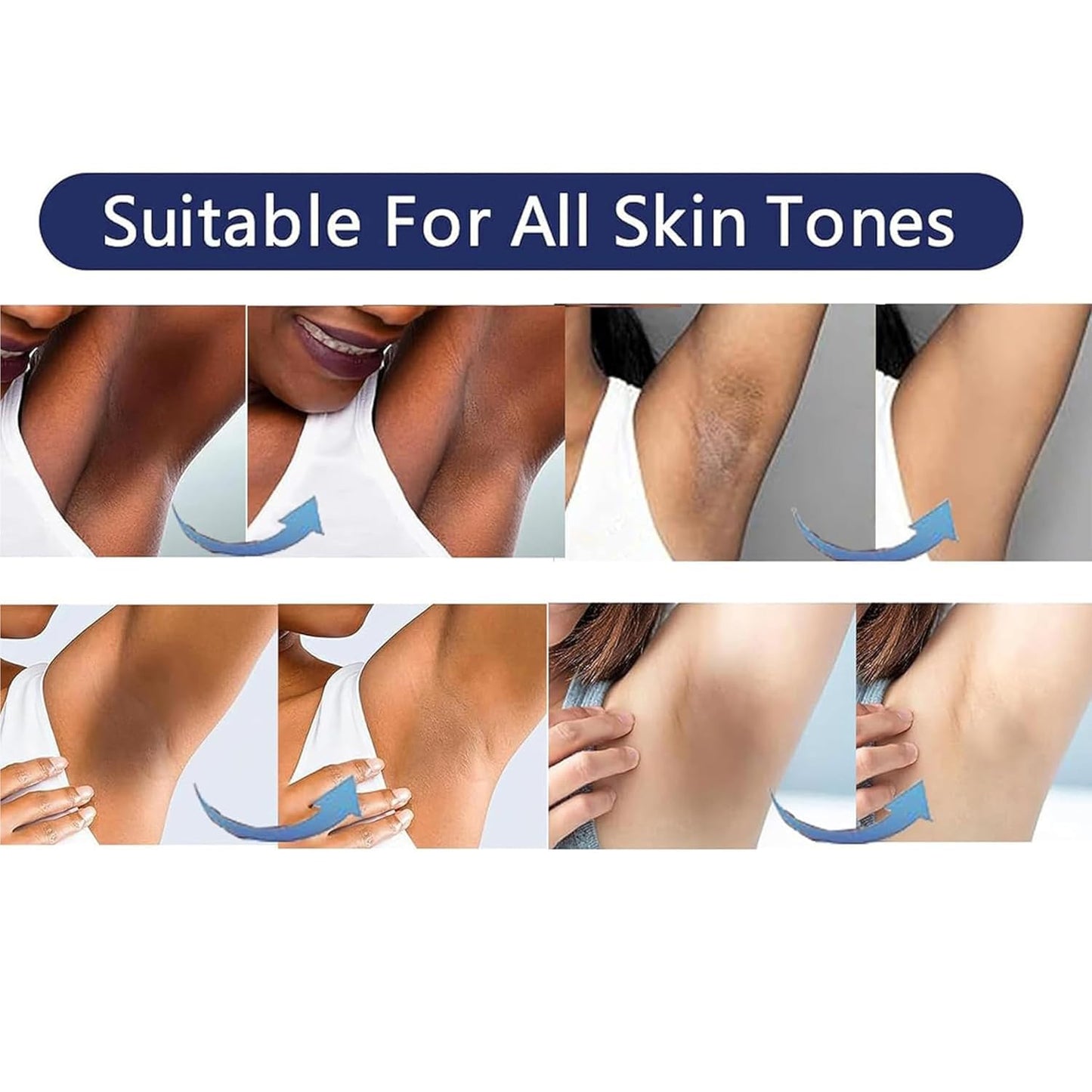 Vcetree Skin Bleaching Cream Skin Lightening for Body Intimate Areas, Private Parts, Underarm, Knees, Elbows, Inner Thigh, Bikini Area Vcetree