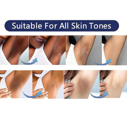 Vcetree Skin Bleaching Cream Skin Lightening for Body Intimate Areas, Private Parts, Underarm, Knees, Elbows, Inner Thigh, Bikini Area Vcetree