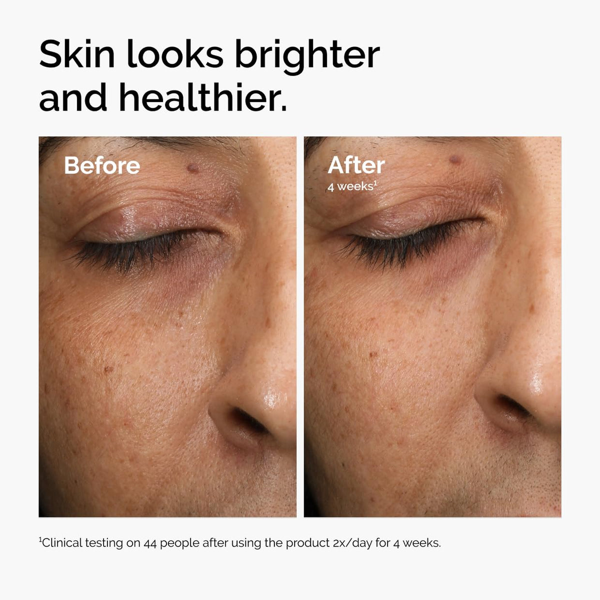 The Ordinary Multi-Antioxidant Radiance Serum, Vitamin C Serum For Face, Brighten & Protect Skin – Boosts Glow & Shields Against Environmental Stressors, 1 Fl Oz The Ordinary