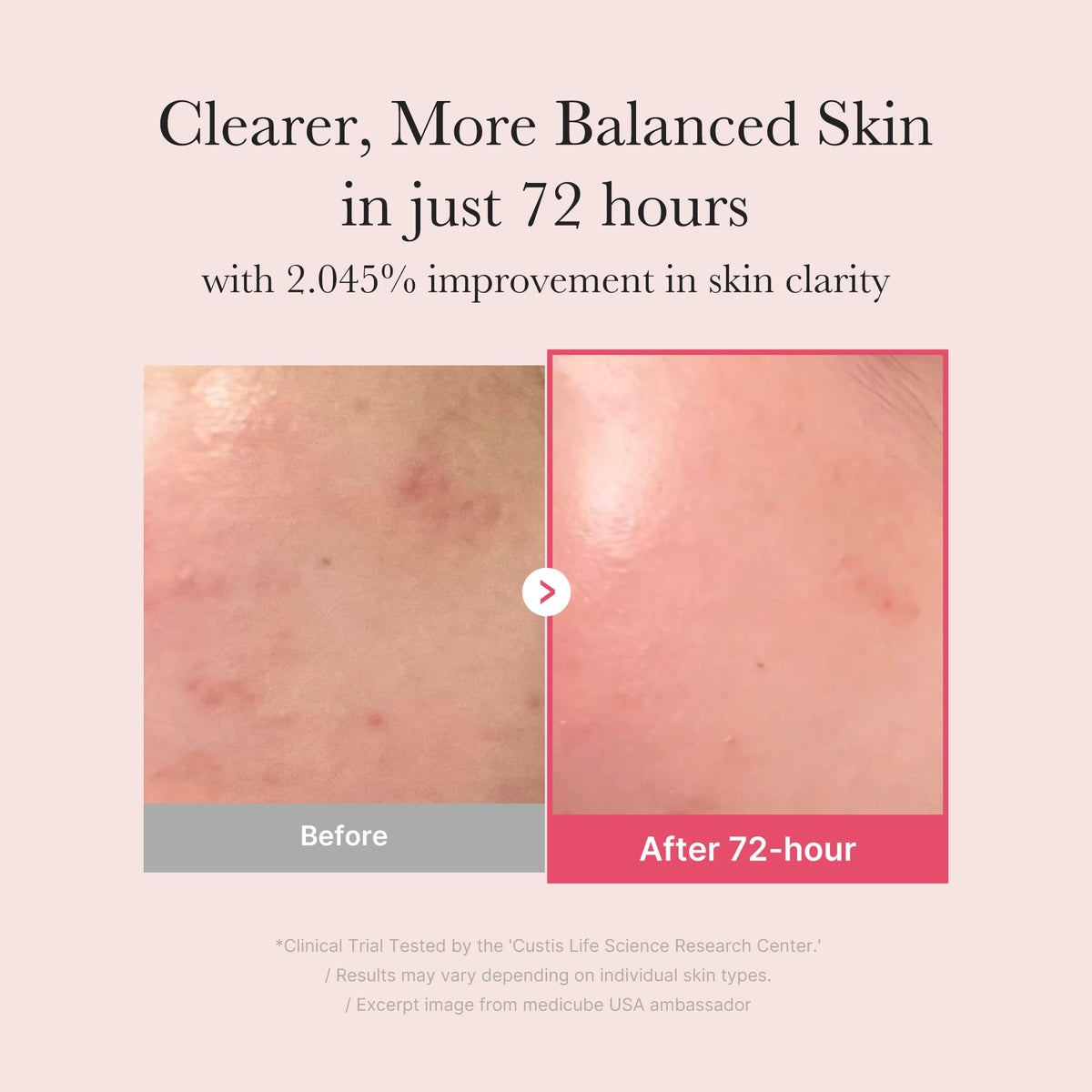medicube TXA&Niacinamide 15% Glow Serum medicube
