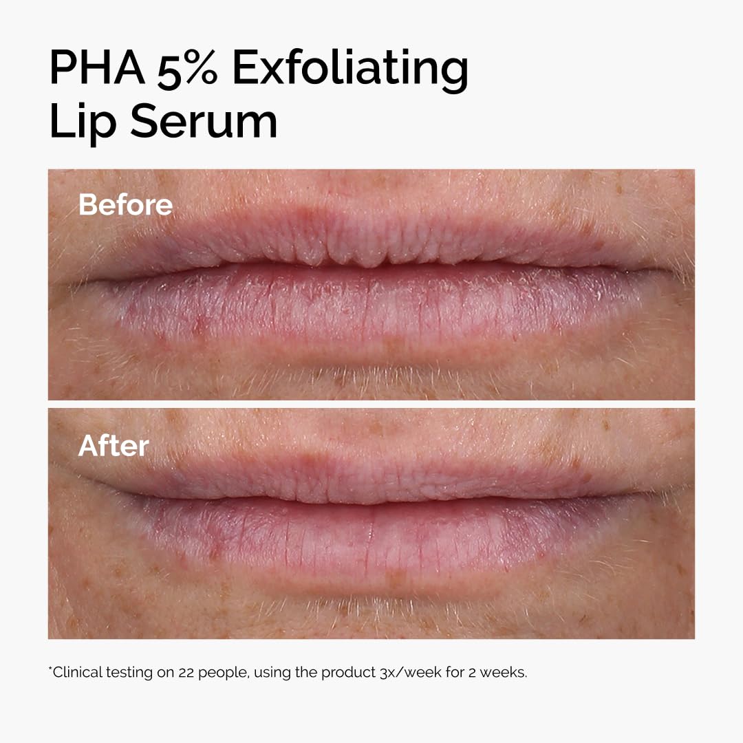 The Ordinary PHA 5% Exfoliating Lip Serum, Hydrating Overnight Lip Exfoliator Treatment, 0.5 Fl Oz The Ordinary
