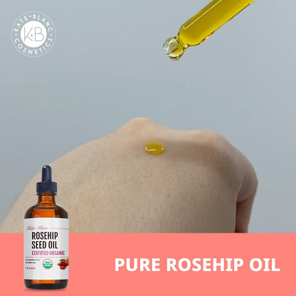Kate Blanc Cosmetics Rosehip Seed Oil for Face, 100% Pure, Organic (1oz) Kate Blanc Cosmetics