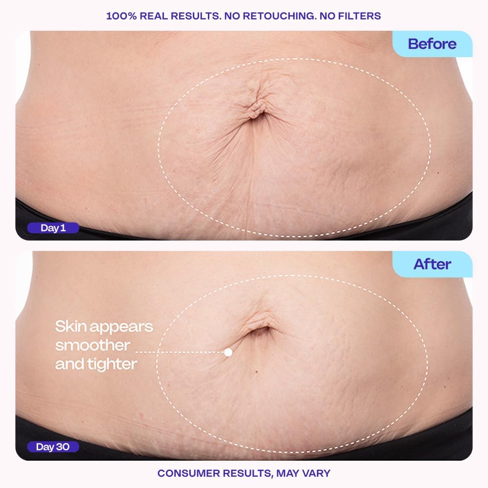 goPure Firming Belly Cream - Body Firming Moisturizer for Visible Cellulite & Stretch Mark Reduction, 4.25oz goPure