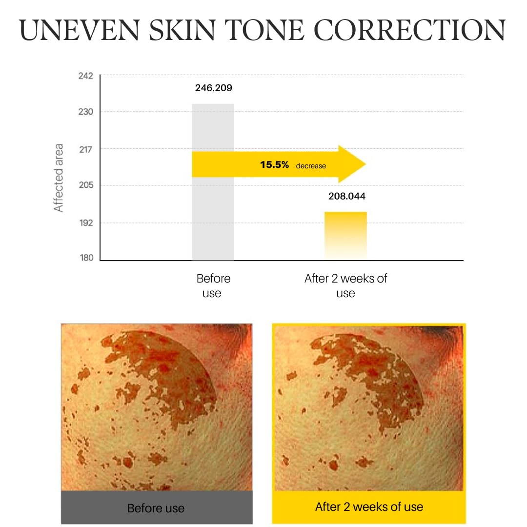 d'alba Piedmont White Truffle Vita Toning Serum Toner, Glass Skin with Double Vitamin Skincare, Face Moisturizer, (6.09 fl. oz) d'alba Piedmont