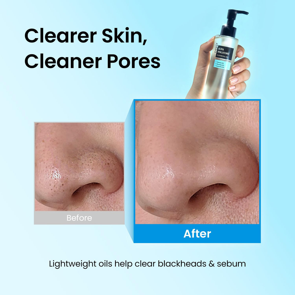 coxir Ultra Hyaluronic Cleansing Oil, Hydrating Makeup Remover, 5.07 fl.oz coxir