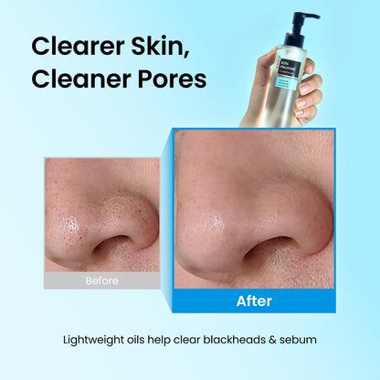 coxir Ultra Hyaluronic Cleansing Oil, Hydrating Makeup Remover, 5.07 fl.oz coxir