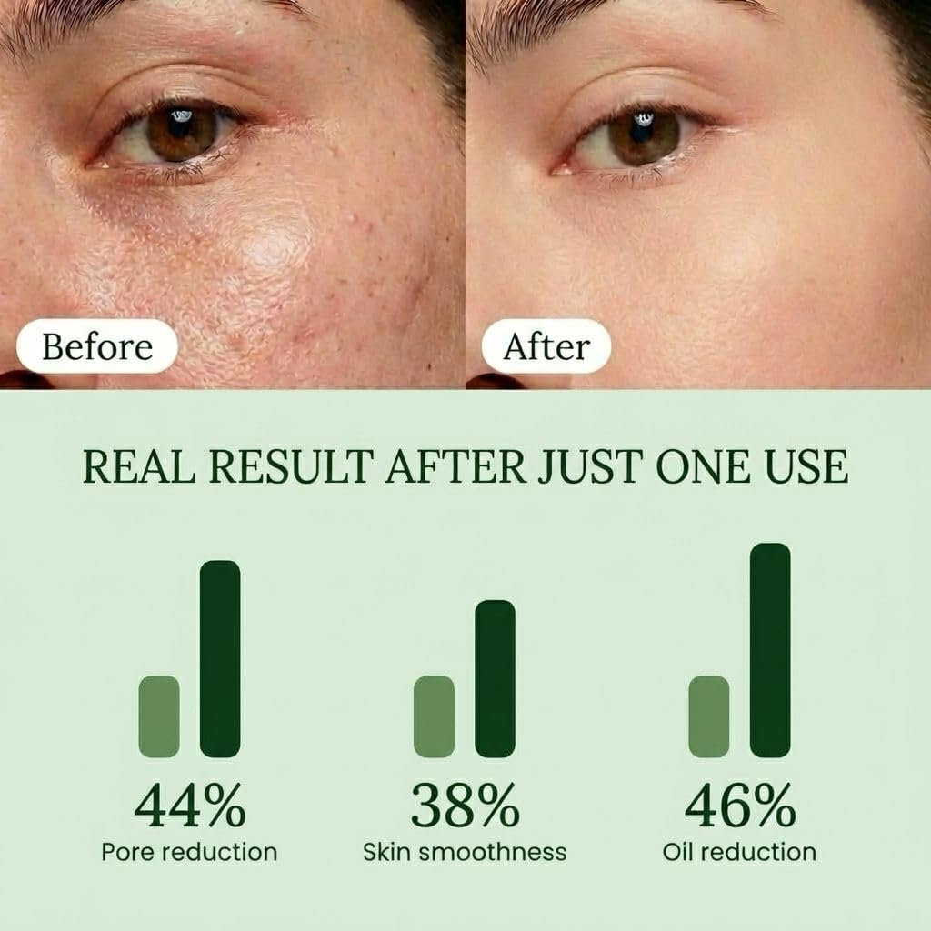 QUIA Toner Pads – AHA/BHA Dual-Action Exfoliate and Hydrate All in One – Soothing Formula for Sensitive Skin – Reduces Blackheads and Blemishes QUIA Beauty