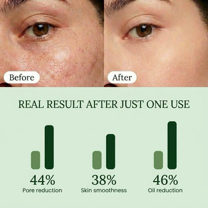 QUIA Toner Pads – AHA/BHA Dual-Action Exfoliate and Hydrate All in One – Soothing Formula for Sensitive Skin – Reduces Blackheads and Blemishes QUIA Beauty