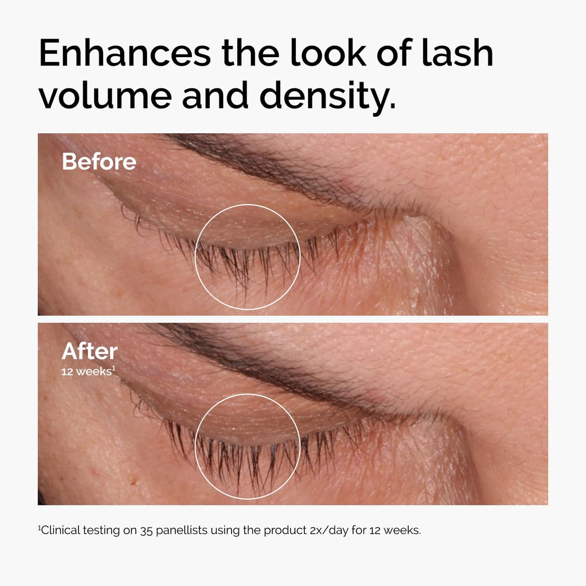 The Ordinary Multi-Peptide Lash and Brow Serum, Peptide-Powered Formula for Thicker, Fuller Looking Lashes & Brows, 0.16 Fl Oz The Ordinary