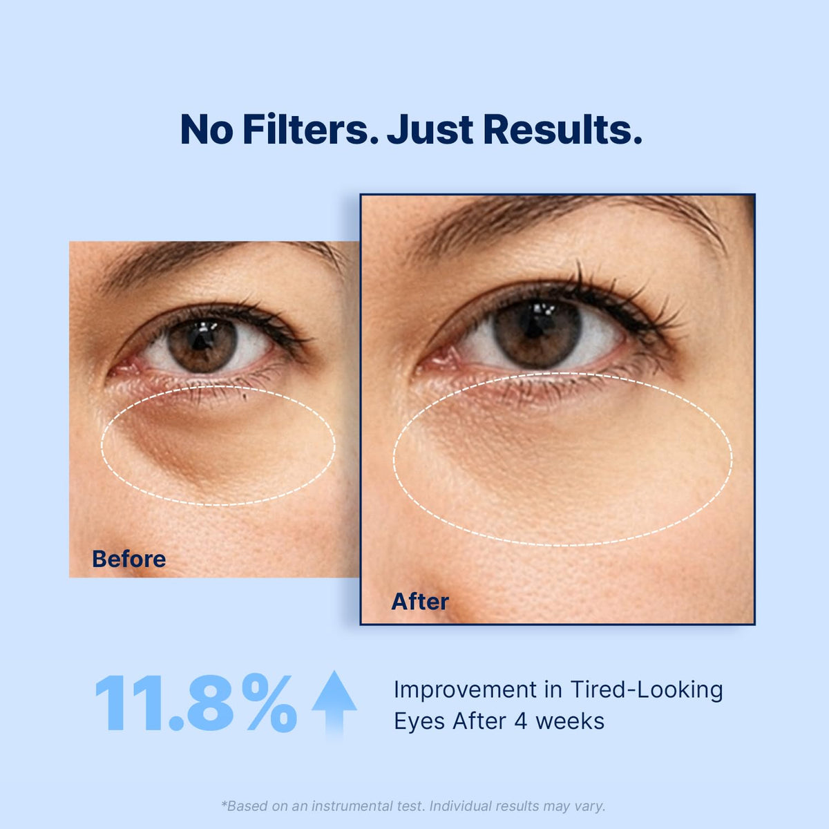 Enaskin Naturals Under Eye Patches for Puffy Eyes & Dark Circles 60 Patches Enaskin Naturals