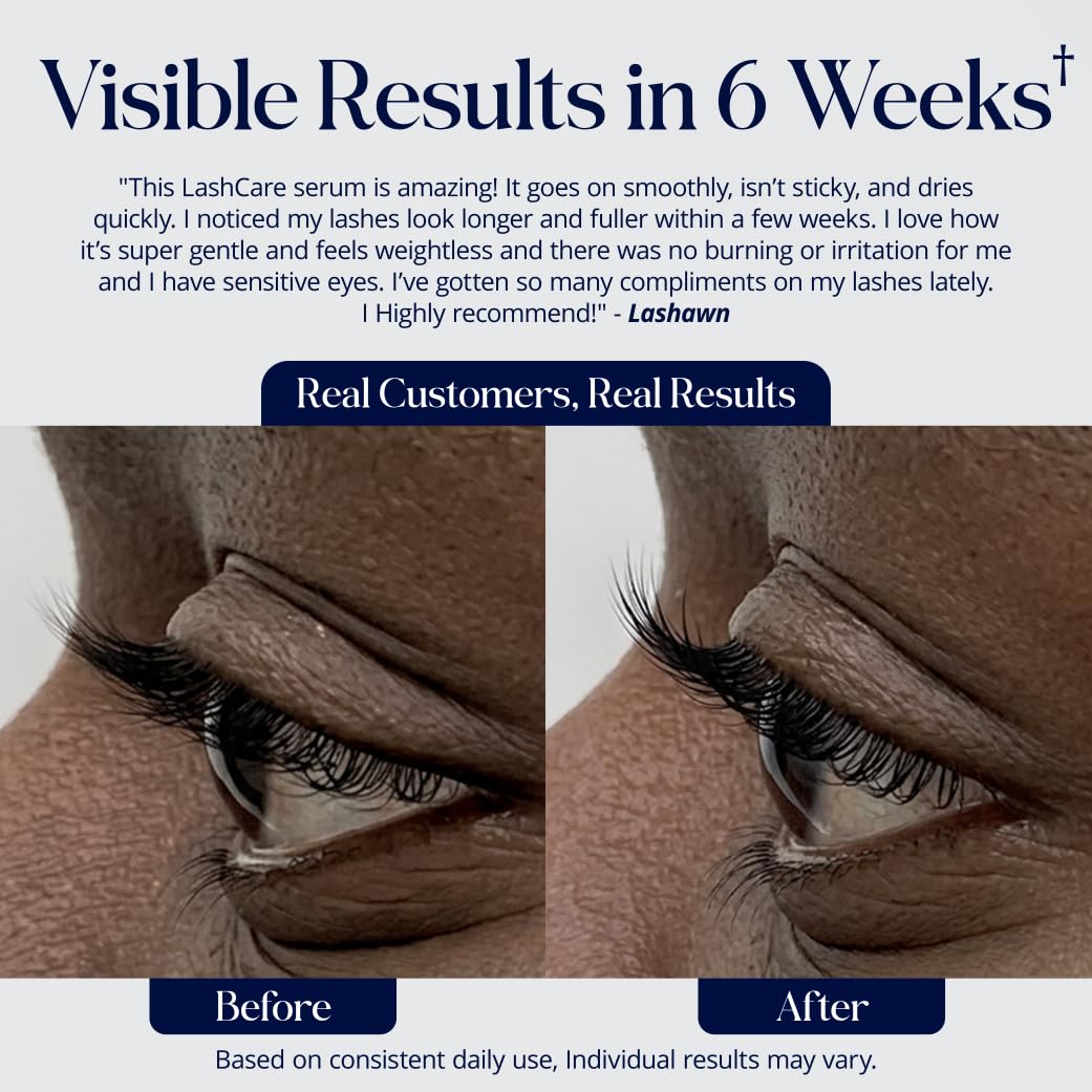 SugarbearPRO LashCare Vitamin Serum with Peptides MSM and Biotin | Vegan Formula | 3 Month Supply for Fuller Healthier Looking Lashes