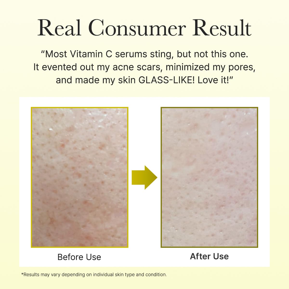 Arencia Vitamin C Booster Shot Serum with Glutathione, Niacinamide and Vitamin E for Dark Spot Care, Fine Lines & Wrinkles ARENCIA