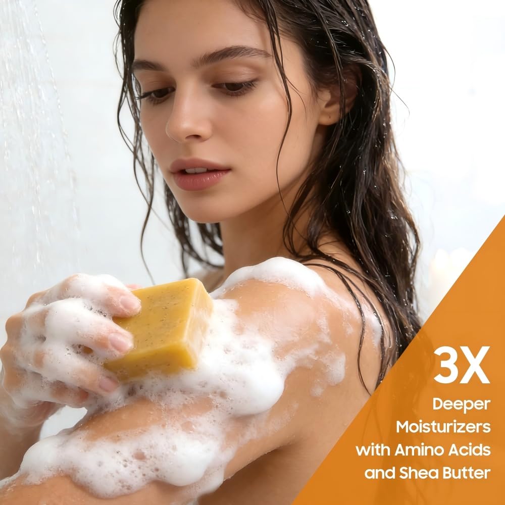Uselective Lemon & Turmeric Soap Bar for Dark Spots, Powered by Kojic Acid & Vitamin C - Deeply Moisturizing with Amino Acids & Shea Butter - SLS Free for Face/Body Uselective