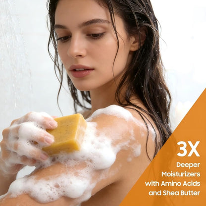Uselective Lemon & Turmeric Soap Bar for Dark Spots, Powered by Kojic Acid & Vitamin C - Deeply Moisturizing with Amino Acids & Shea Butter - SLS Free for Face/Body Uselective