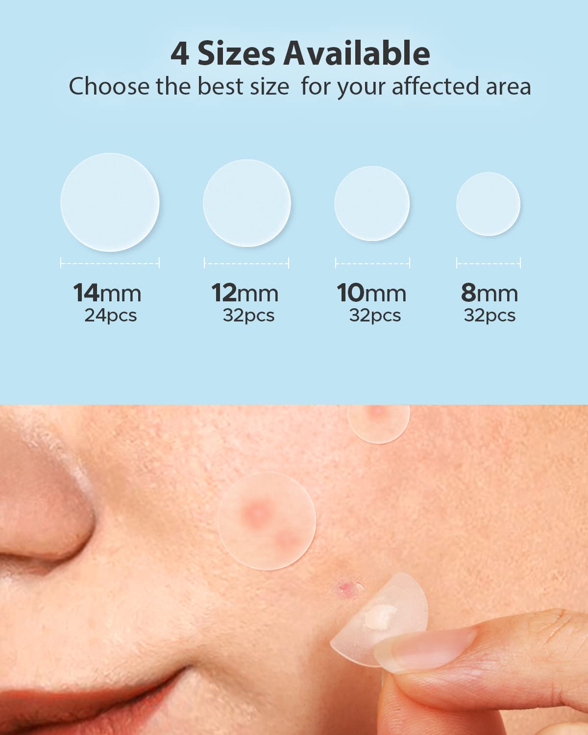 LitBear Acne Pimple Patches- Day and Night 4 Sizes 180 Dots Thin & Thick Hydrocolloid Patches with Witch Hazel, Tea Tree & Calendula Oil, Pimple Stickers for Covering Zits, Spots, Acne Dots LitBear