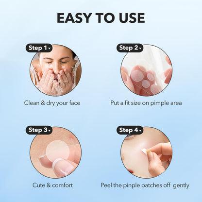 QUSTERE Pimple Patches for Face, Hydrocolloid Acne Patches, Cute Round Shape Zit Covers, Spot Stickers with Tea Tree, Salicylic Acid & Cica Oil| 2 Sizes (9mm, 12mm) |288 Count QUSTERE