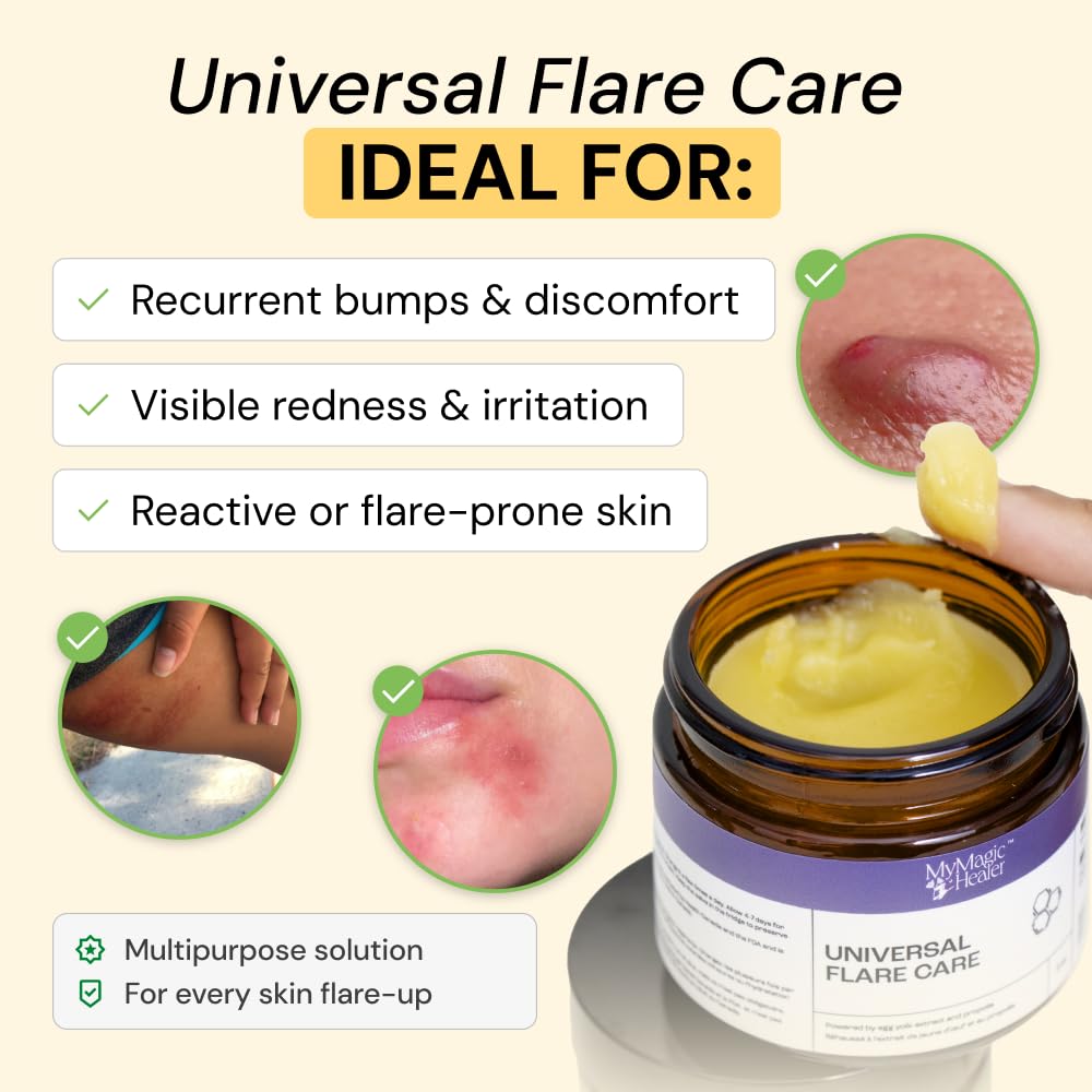 MyMagicHealer Universal Flare Care – Solution for Everyday Skin Flare-Ups | Drawing Salve for Boils & Cysts, Hidradenitis Suppurativa, Folliculitis | Irritated Skin and Chafing Relief 1 oz MyMagicHealer