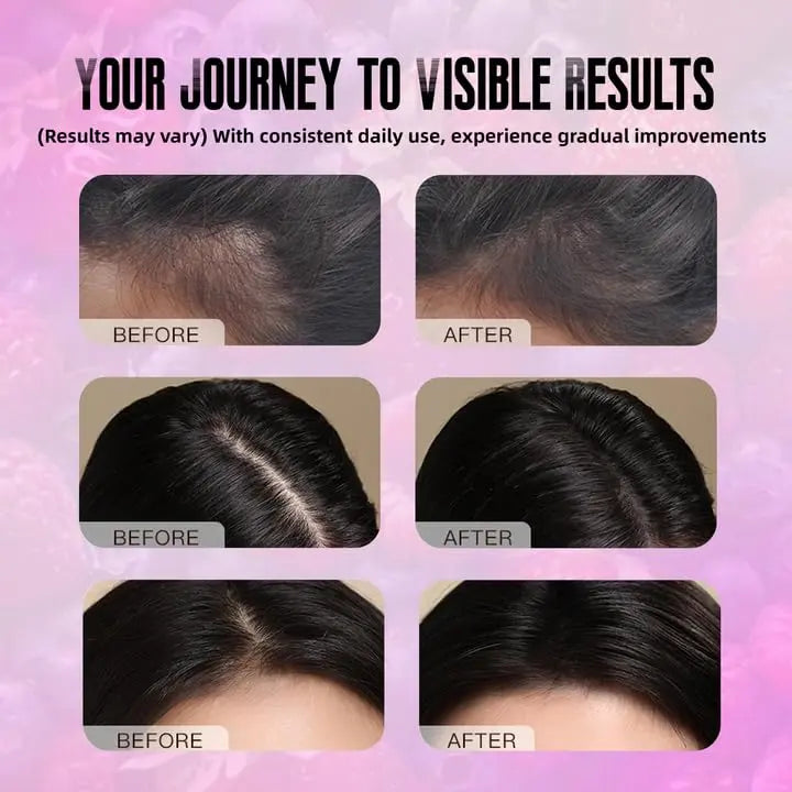 BDQBDQ Lumin Hair Growth Gummies, Infused with Biotin, Vitamins, and Botanical Extracts to Support Healthy Hair Growth and Strength BDQBDQ buy australia supplements