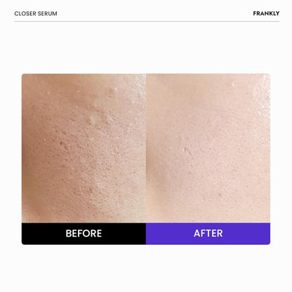 FRANKLY Closer Serum | Pore Minimizer Serum | 1.01 fl oz FRANKLY