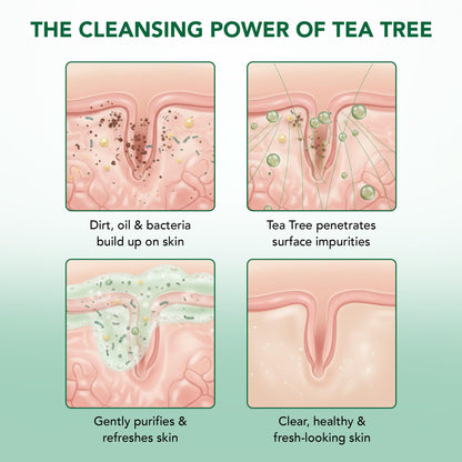 Botanic Hearth Tea Tree Body Wash -16 fl oz- All-Natural Antifungal & Odor-Control Shower Botanic Hearth