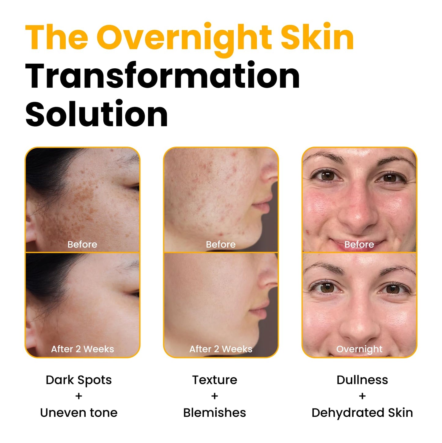 QUIA Turmeric + Kojic Acid Overnight Wrapping Mask – Hydration Mask for Glowing Skin QUIA Beauty