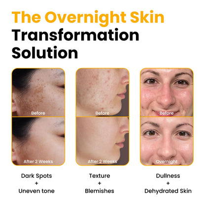 QUIA Turmeric + Kojic Acid Overnight Wrapping Mask – Hydration Mask for Glowing Skin QUIA Beauty