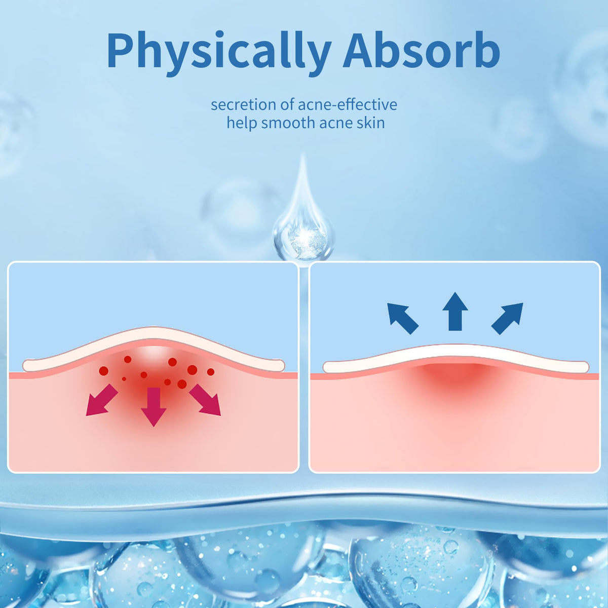 Daolyo Pimple Patches for Face, 4 Size 300 Counts Hydrocolloid Acne Patches Daolyo
