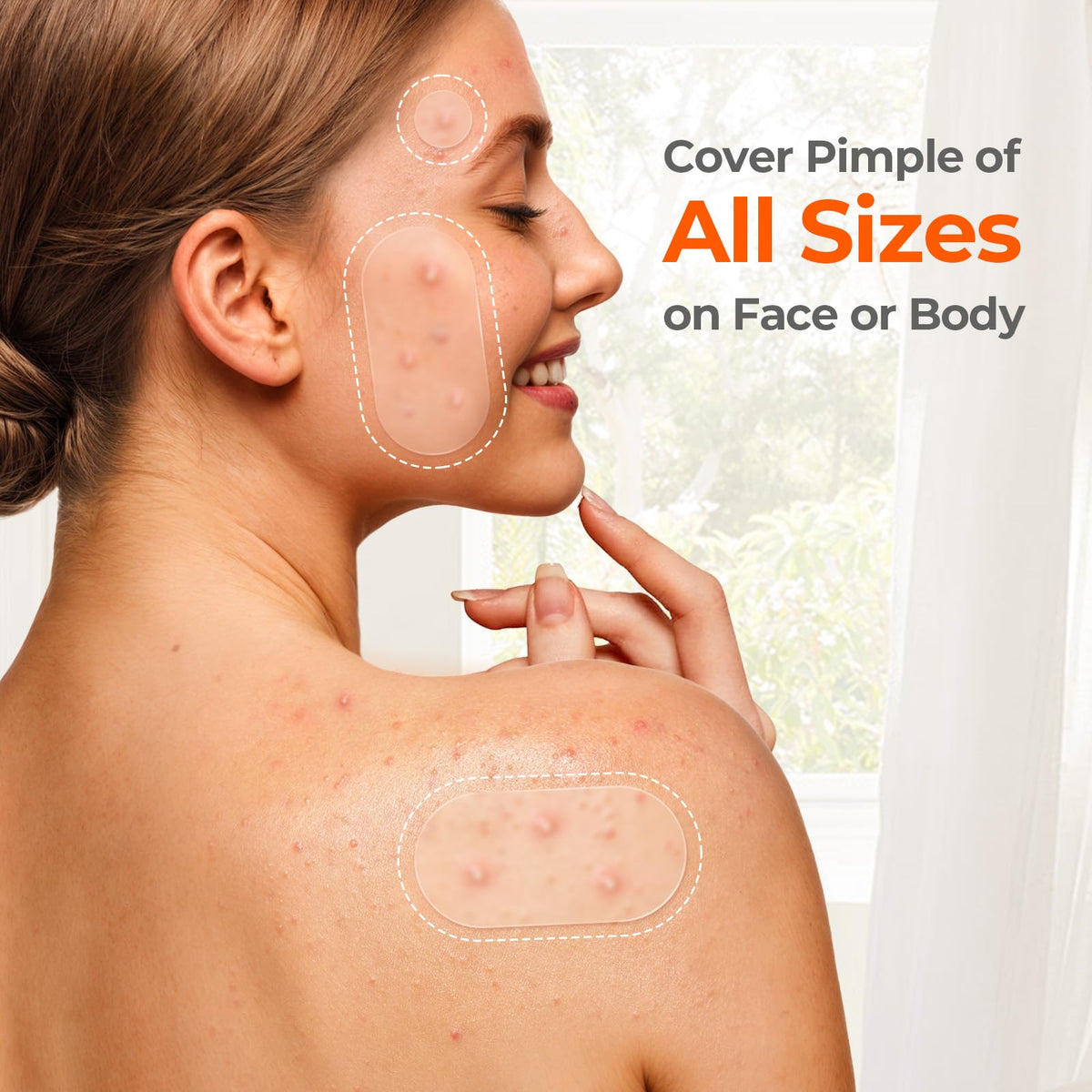 TKTK 443 Count Pimple Patches for Face, Hydrocolloid Acne Cover Patch Bulk TKTK
